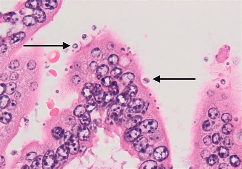  Cryptosporidium: Un Parasite Microscopique Qui Donne le Vertige à l'Intestin!