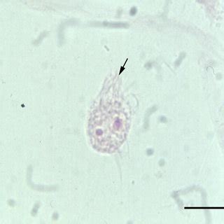  Lophomonas! Un petit voyage dans l’univers microscopique d’une créature à la fois élégante et fascinante