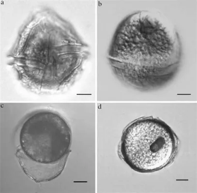 Peridinium! Un Délice Planctonique Lumineux et Rotatif dans le Monde Microscopique !